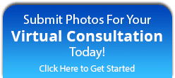 Virtual Consultation at Marshall Orthodontics in La Mesa, CA