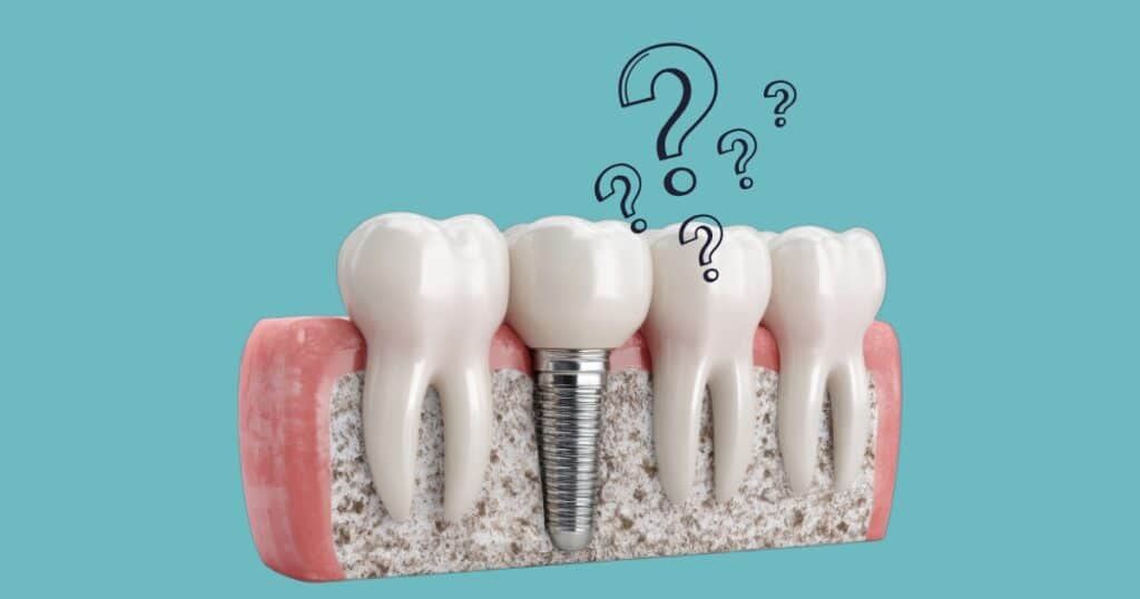 Dental implant.